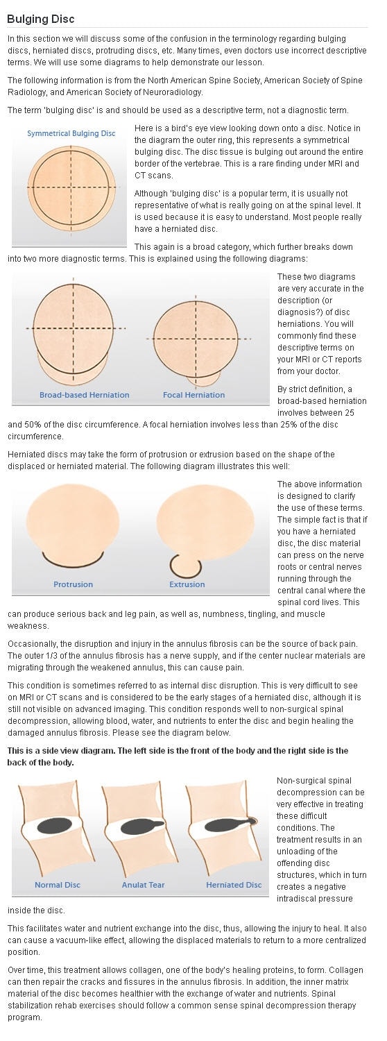 Kevin Fielder Bulged Disc